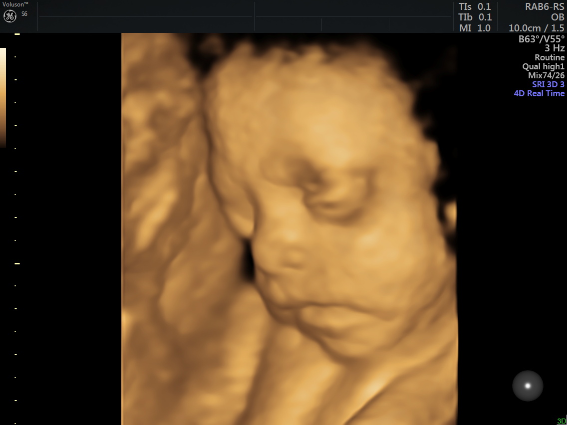 midyat kadın doğum uzmanı